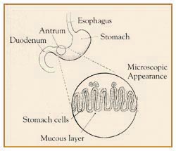 hpylori1