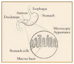 hpylori1