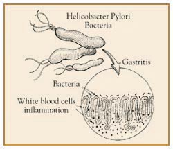 hpylori2